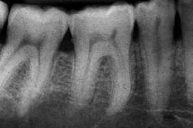 dental-radiology1